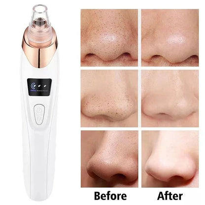 Upgraded Blackhead Remover Vacuum Facial Pore Cleaner Electric Acne Comedone Whitehead Extractor Tool 5 Probes For Women And Men